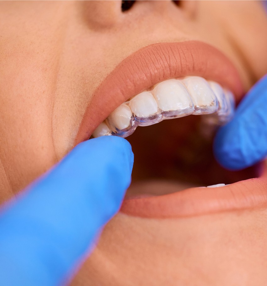 woman getting invisalign